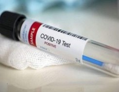   مصر اليوم - فيتامين (د) واللوميستيرول يظهران نتائج واعدة في إمكانية علاج كوفيد-19