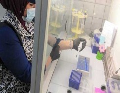   مصر اليوم - ابتكار جزيئات تقتل البكتيريا المقاومة للمضادات الحيوية