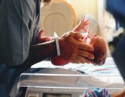   مصر اليوم - ولادة طفل في الهند مع ذراع ثالثة في ظهره بسبب حالة طبية نادرة
