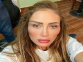   مصر اليوم - ريهام سعيد تتهم طبيب تجميل بتشويه وجهها