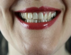   مصر اليوم - تسوس الأسنان يؤثر على العلاقات الاجتماعية وقد يؤدي للوفاة