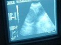   مصر اليوم - أمريكا تطور اختبار جديد للحوامل يكشف الإضرابات الوراثية قبل ولادة الجنين