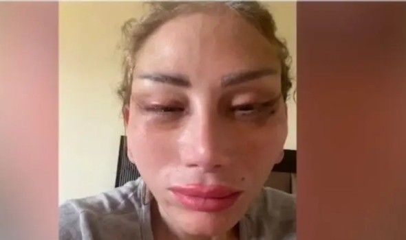   مصر اليوم - الإعلامية ريهام سعيد تكشف عن تشوه وجهها على يد طبيب تجميل شهير